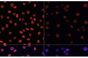Immunofluorescence analysis of C6 cells using Acetyl-Histone H4-K91 Polyclonal Antibody at dilution of 1:100.