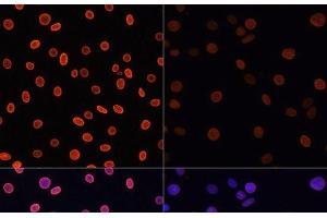 Immunofluorescence analysis of C6 cells using Acetyl-Histone H4-K91 Polyclonal Antibody at dilution of 1:100. (Histone H4 antibody  (acLys91))