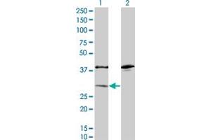 Western Blot analysis of SULT1A1 expression in transfected 293T cell line by SULT1A1 monoclonal antibody (M01A), clone 1F8. (SULT1A1 antibody  (AA 1-295))