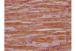 IHC image of ABIN7159742 diluted at 1:400 and staining in paraffin-embedded human heart tissue performed on a Leica BondTM system. (MACF1 antibody  (AA 1936-2150))