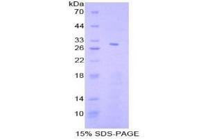 SDS-PAGE analysis of Human STAT4 Protein. (STAT4 Protein)