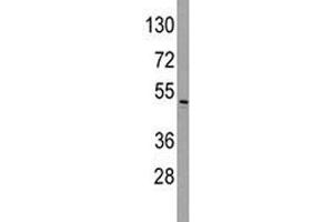 Western blot analysis of ILK antibody and HeLa lysate.
