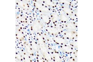 Immunohistochemistry of paraffin-embedded mouse kidney using PBRM1 Rabbit mAb (ABIN1512585, ABIN3020942, ABIN3020943 and ABIN7101308) at dilution of 1:100 (40x lens). (Polybromo 1 antibody)