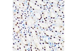 Immunohistochemistry of paraffin-embedded mouse kidney using PBRM1 Rabbit mAb (ABIN1512585, ABIN3020942, ABIN3020943 and ABIN7101308) at dilution of 1:100 (40x lens).