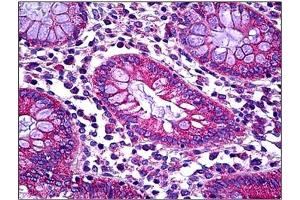 Human Colon: Formalin-Fixed, Paraffin-Embedded (FFPE). (TAUT antibody  (C-Term))