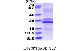 SDS-PAGE (SDS) image for Matrix Metallopeptidase 23B (MMP23B) (AA 79-254) protein (His tag) (ABIN5853678)