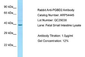 Western Blotting (WB) image for anti-PiggyBac Transposable Element Derived 2 (PGBD2) (Middle Region) antibody (ABIN2785716) (PGBD2 antibody  (Middle Region))