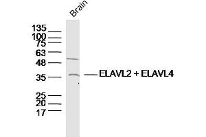 Lane 1: Mouse brain lysates probed with Anti –ELAVL2 + ELAVL4 Polyclonal Antibody, Unconjugated (bs-11743R) at 1:300 overnight at 4˚C. (Elavl2 + Elavl4 (AA 31-110) antibody)