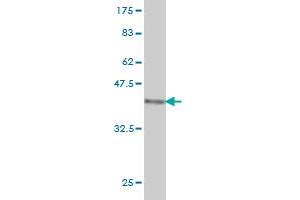 Western Blot detection against Immunogen (36. (SORL1 antibody  (AA 82-181))