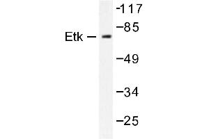 Image no. 1 for anti-BMX Non-Receptor Tyrosine Kinase (BMX) antibody (ABIN272021) (BMX antibody)