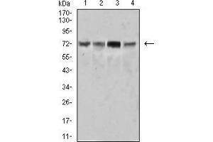 Western Blotting (WB) image for anti-Spleen tyrosine Kinase (SYK) (AA 217-356) antibody (ABIN5542636)