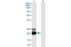 Western Blot analysis of GH1 expression in transfected 293T cell line by GH1 monoclonal antibody (M02), clone 8G6.