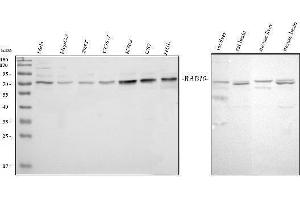 Western blot analysis of GRB10 using anti-GRB10 antibody (ABIN7599160).