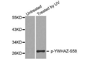 Western blot analysis of extracts from HeLa cells, using Phospho-YWHAZ-S58 antibody (ABIN2987575). (14-3-3 zeta antibody  (pSer58))