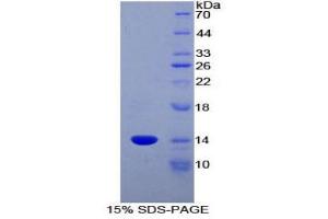 SDS-PAGE (SDS) image for Chemokine (C-C Motif) Ligand 6 (CCL6) (AA 21-115) protein (His tag) (ABIN2125773)