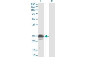 Western Blot analysis of NBL1 expression in transfected 293T cell line by NBL1 monoclonal antibody (M02), clone 1G5. (NBL1 antibody  (AA 21-130))