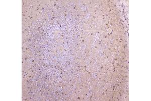 IHC analysis of WWOX using anti-WWOX antibody . (WWOX antibody  (AA 1-245))