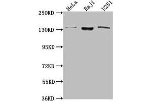 Western Blot Positive WB detected in: Hela whole cell lysate, Raji whole cell lysate, U251 whole cell lysate All lanes: LARS antibody at 1:2000 Secondary Goat polyclonal to rabbit IgG at 1/50000 dilution Predicted band size: 135, 129, 56 kDa Observed band size: 135 kDa (LARS antibody  (AA 614-892))