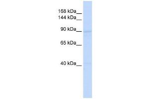 RAD54B antibody used at 1 ug/ml to detect target protein. (RAD54B antibody)