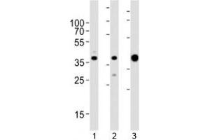 Western blot analysis of lysate from 1) MCF-7, 2) HeLa cell line and 3) human skeletal muscle tissue lysate using ALDOA antibody at 1:1000. (ALDOA antibody  (AA 303-331))