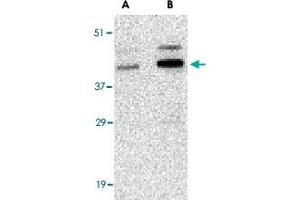 Western blot analysis of CCNO in human bladder tissue lysate with CCNO polyclonal antibody  at (A) 1 and (B) 2 ug/mL . (Cyclin O antibody  (Internal Region))