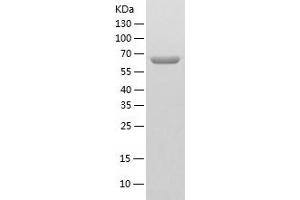 Western Blotting (WB) image for Protein Phosphatase 2, Regulatory Subunit A, alpha (PPP2R1A) (AA 1-589) protein (His tag) (ABIN7285923) (PPP2R1A Protein (AA 1-589) (His tag))
