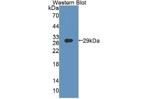Detection of Recombinant ABCF1, Human using Polyclonal Antibody to ATP Binding Cassette Transporter F1 (ABCF1) (ABCF1 antibody  (AA 625-845))