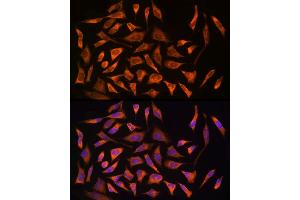 Immunofluorescence (IF) image for anti-Nucleotide-Binding Oligomerization Domain Containing 2 (NOD2) (AA 611-910) antibody (ABIN7269065)
