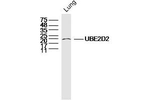 Mouse lung lysates probed with UBE2D2 Polyclonal Antibody, Unconjugated  at 1:300 dilution and 4˚C overnight incubation. (UBE2D2 antibody  (AA 31-130))