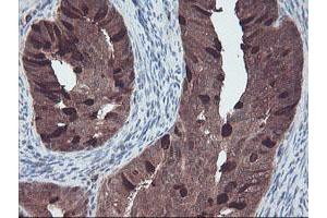 Image no. 2 for anti-RAB, Member of RAS Oncogene Family-Like 2A (RABL2A) antibody (ABIN1500575) (RABL2A antibody)