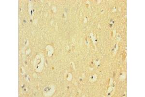 Immunohistochemistry of paraffin-embedded human brain tissue using ABIN7149094 at dilution of 1:100 (CYBB antibody  (AA 283-570))