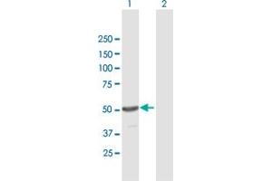 Western Blot analysis of TINF2 expression in transfected 293T cell line by TINF2 MaxPab polyclonal antibody. (TINF2 antibody  (AA 1-451))