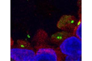 Paraffin embedded normal breast tissue section was stained with anti-acetylated tubulin (IgG2b) and γ-tubulin (IgG1) followed by Goat Anti-Mouse IgG2b, Human ads-TRITC