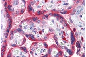 Anti-ADAM15 antibody IHC staining of human placenta. (ADAM15 antibody  (AA 1-225))