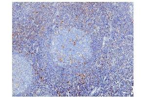 IHC analysis of STAT1 using anti STAT1 antibody (ABIN6719375).