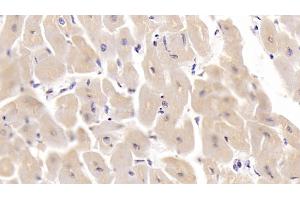 Detection of SHBG in Human Cardiac Muscle Tissue using Monoclonal Antibody to Sex Hormone Binding Globulin (SHBG) (SHBG antibody  (AA 224-388))