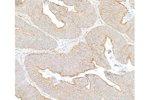 Immunohistochemistry (IHC) image for anti-Spectrin Beta, Non-Erythrocytic 1 (SPTBN1) (AA 2100-2150) antibody (ABIN7454694)