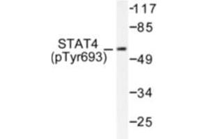 Image no. 1 for anti-Signal Transducer and Activator of Transcription 4 (STAT4) (pTyr693) antibody (ABIN318129) (STAT4 antibody  (pTyr693))
