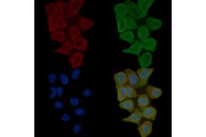 ABIN6263607 and ABIN6272359 staining Hela cells(30 min of UV treatment) by IF/ICC.