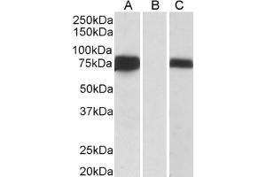 FOXC1 anticorps  (C-Term)