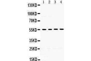 Western Blotting (WB) image for anti-Matrix Metallopeptidase 8 (Neutrophil Collagenase) (MMP8) (AA 120-157), (N-Term) antibody (ABIN3043883) (MMP8 antibody  (N-Term))