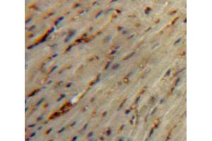 Used in DAB staining on fromalin fixed paraffin-embedded Heart tissue (Secretin antibody  (AA 26-133))