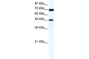 WB Suggested Anti-ZNF446 Antibody Titration:  5. (ZNF446 antibody  (N-Term))