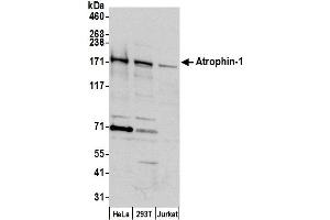anti-Atrophin 1 (ATN1) (C-Term) antibody