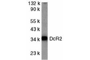 Western Blotting (WB) image for anti-Tumor Necrosis Factor Receptor Superfamily, Member 10d, Decoy with Truncated Death Domain (TNFRSF10D) (Cytoplasmic Domain) antibody (ABIN1030842) (DcR2 antibody  (Cytoplasmic Domain))