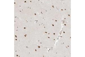 Immunohistochemical staining of human cerebral cortex with NHSL1 polyclonal antibody  shows strong nuclear positivity in neuronal cells at 1:200-1:500 dilution. (NHSL1 antibody)