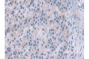 IHC-P analysis of Rat Stomach Tissue, with DAB staining. (PDE4B antibody  (AA 500-736))