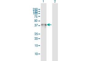 Western Blot analysis of CHIA expression in transfected 293T cell line by CHIA MaxPab polyclonal antibody.