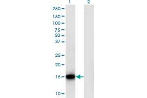 RPLP1 antibody  (AA 1-114)