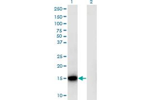 RPLP1 anticorps  (AA 1-114)